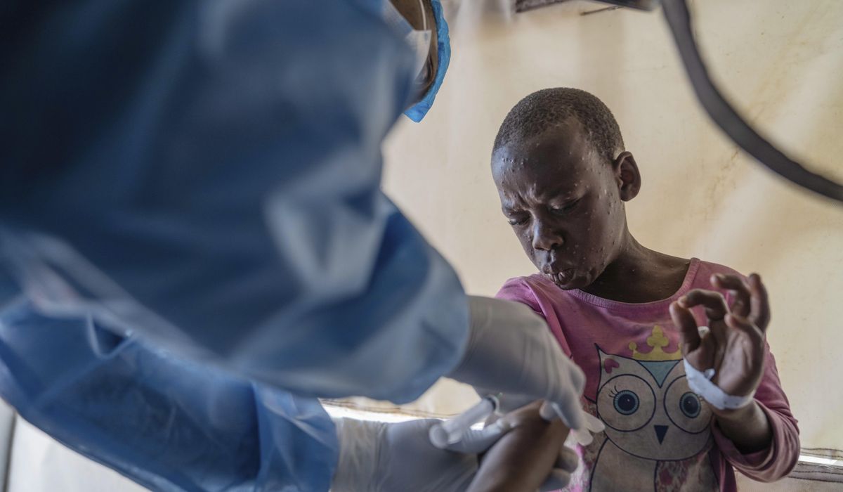 NextImg:WHO grants first mpox vaccine approval to ramp up response to disease in Africa and beyond