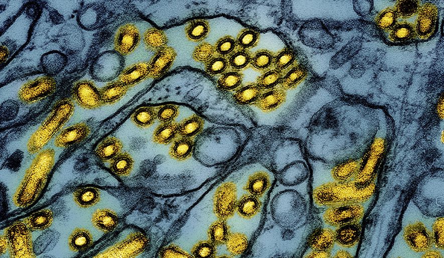 This colorized electron microscope image released by the National Institute of Allergy and Infectious Diseases on March 26, 2024, shows avian influenza A H5N1 virus particles (yellow), grown in Madin-Darby Canine Kidney (MDCK) epithelial cells (blue). (CDC/NIAID via AP, File)