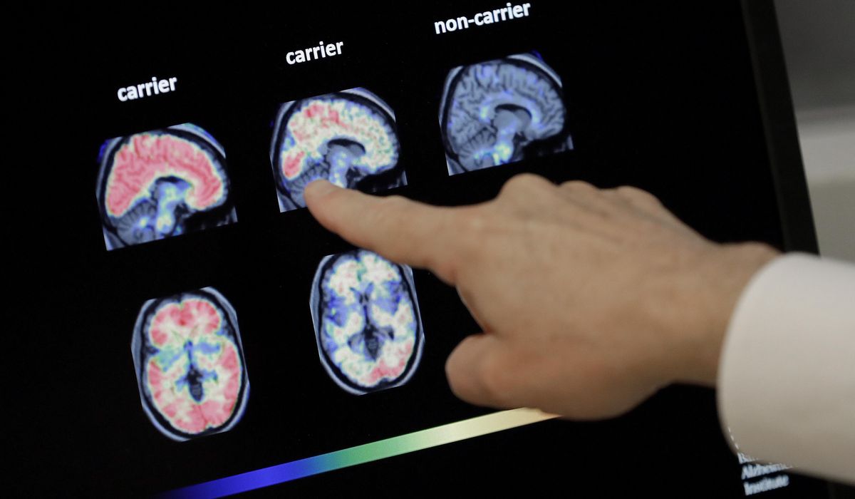 NextImg:Midlife health choices critical in preventing dementia, experts say
