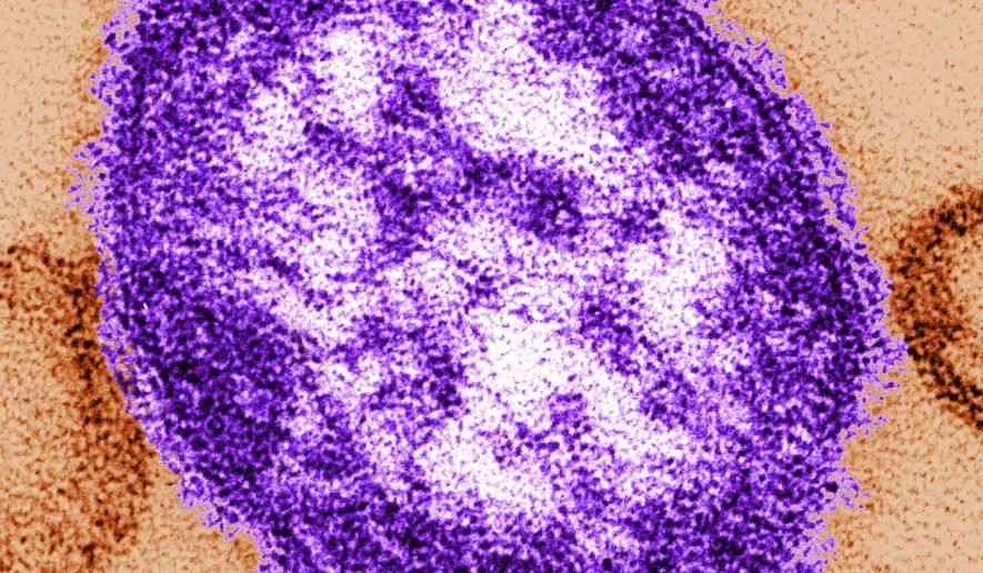 FILE - This undated image made available by the Centers for Disease Control and Prevention on Feb. 4, 2015 shows an electron microscope image of a measles virus particle, center. (Cynthia Goldsmith/Centers for Disease Control and Prevention via AP)
