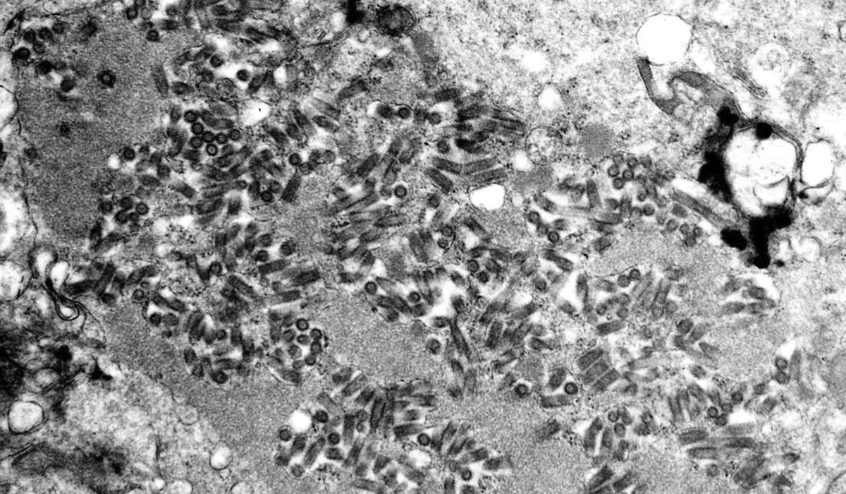 NextImg:Organ transplant patient in Michigan dies from rabies