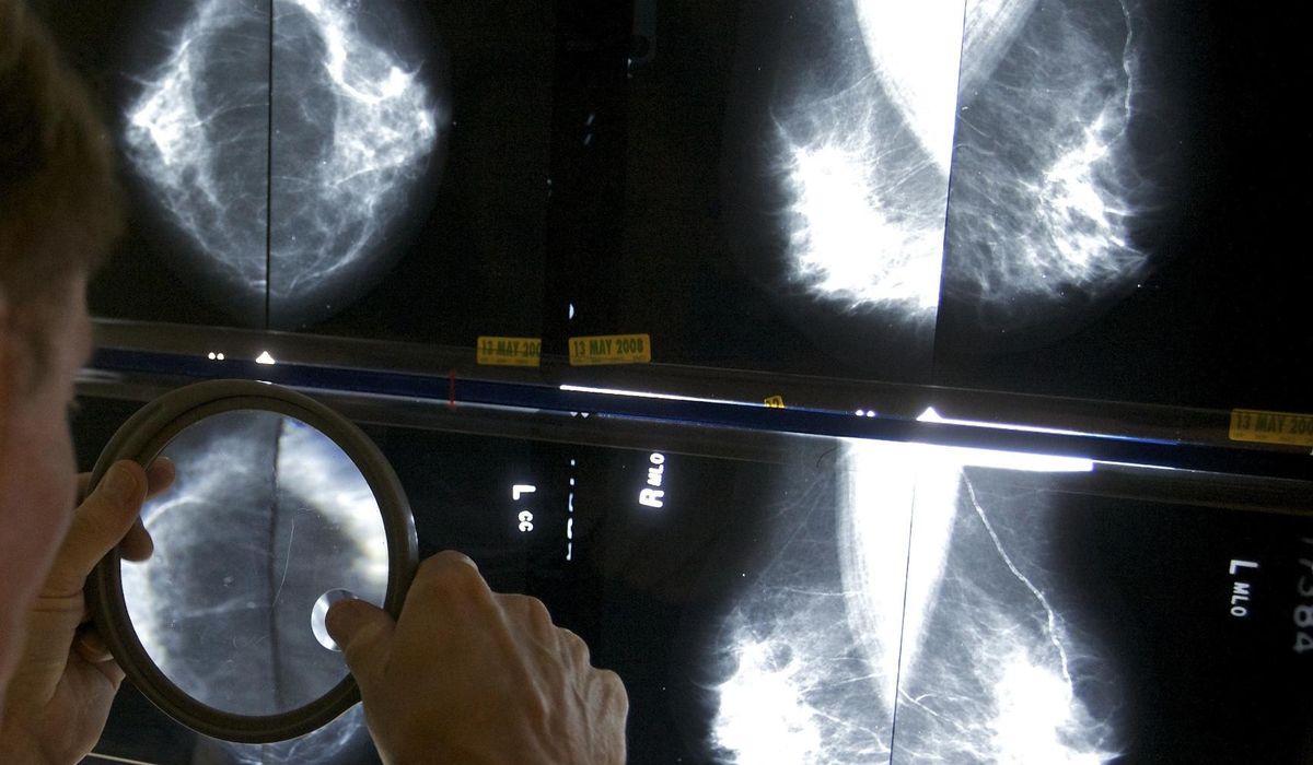 NextImg:Advanced cancers returned to prepandemic levels, according to a reassuring report