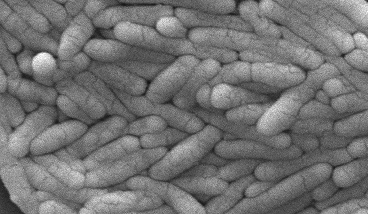NextImg:New salmonella outbreak is linked to backyard poultry, CDC says