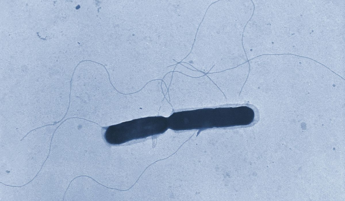 NextImg:Deadly listeria outbreak linked to chicken alfredo fettucine sold at Kroger and Walmart