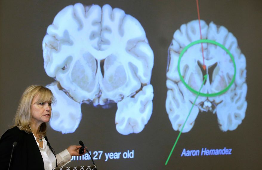 Ann McKee, director of Boston University's center for research into the degenerative brain disease chronic traumatic encephalopathy, or CTE, addresses an audience on the school's campus in Boston about the study of NFL football player Aaron Hernandez's brain on Nov. 9, 2017. (AP Photo/Steven Senne) **FILE**