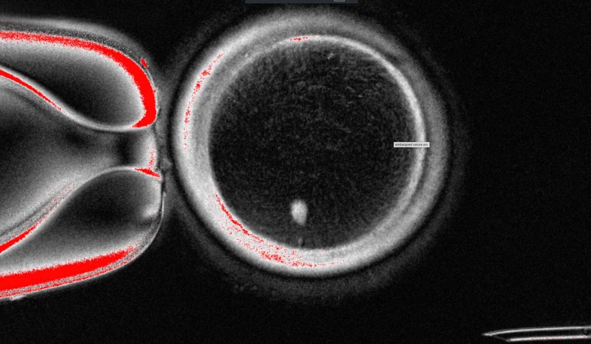 NextImg:Researchers turn human skin cells into eggs — but not yet usable ones