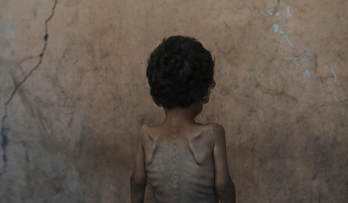 NextImg:Nearly 55,000 children in Gaza under age 5 may be acutely malnourished, a new U.N. study finds