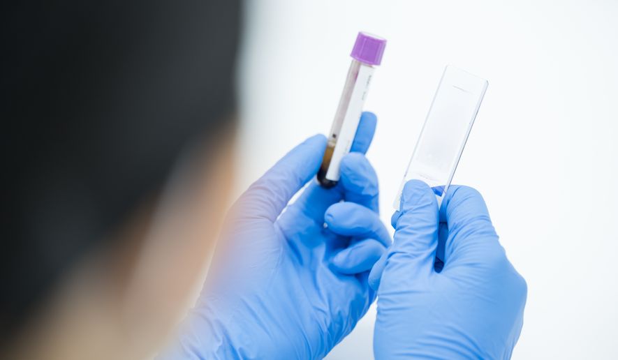 Selective focus technician blue glove hand holding blood test tube and glasses slide for scientist diagnosis count blood cells, CBC on white background at laboratory department in the hospital. File photo credit: Komsan Loonprom via Shutterstock.