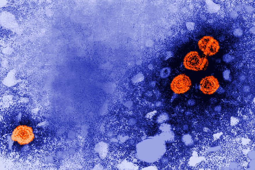 This 1981 electron microscope image made available by the U.S. Centers for Disease Control and Prevention shows hepatitis B virus particles, indicated in orange. (Dr. Erskine Palmer/CDC via AP, File)