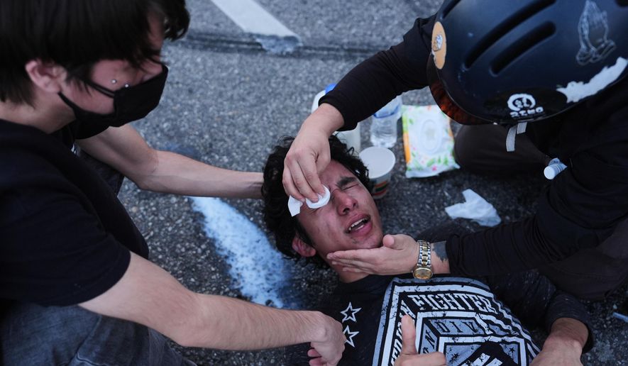 A protester's eyes are washed out after getting tear gassed during a scuffle between federal police at the Metropolitan Detention Center in downtown Los Angeles on Friday, Jan. 30, 2026. (AP Photo/Jae C. Hong)