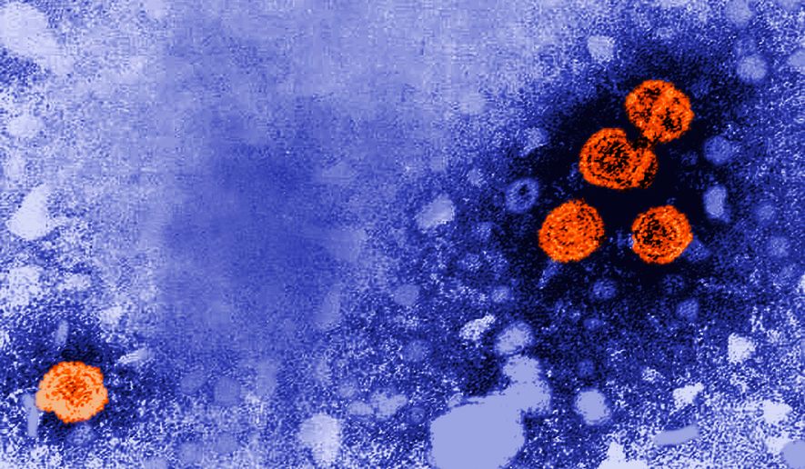 FILE - This 1981 electron microscope image made available by the U.S. Centers for Disease Control and Prevention shows hepatitis B virus particles, indicated in orange. (Dr. Erskine Palmer/CDC via AP, File)