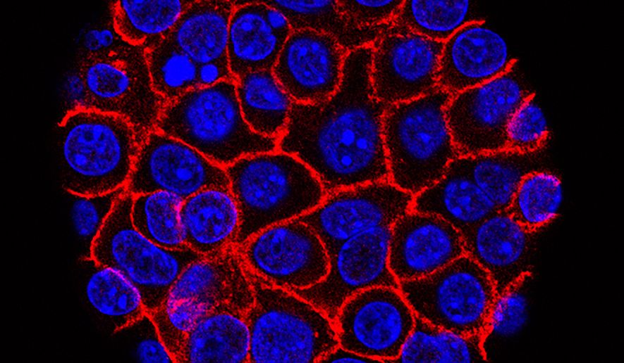 FILE - This undated microscope image from USC via the NIH shows pancreatic cancer cells, nuclei in blue, growing as a sphere encased in membranes, red. (Min Yu/Eli and Edythe Broad Center for Regenerative Medicine and Stem Cell Research at USC, USC Norris Comprehensive Cancer Center, File)