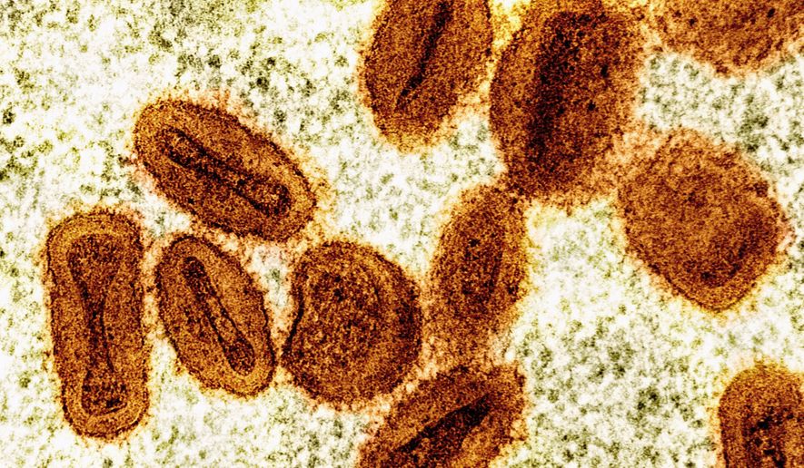 This colorized electron microscope image provided by the National Institute of Allergy and Infectious Diseases in 2024 shows Mpox virus particles, orange, found within infected cells, green. (NIAID via AP, File)