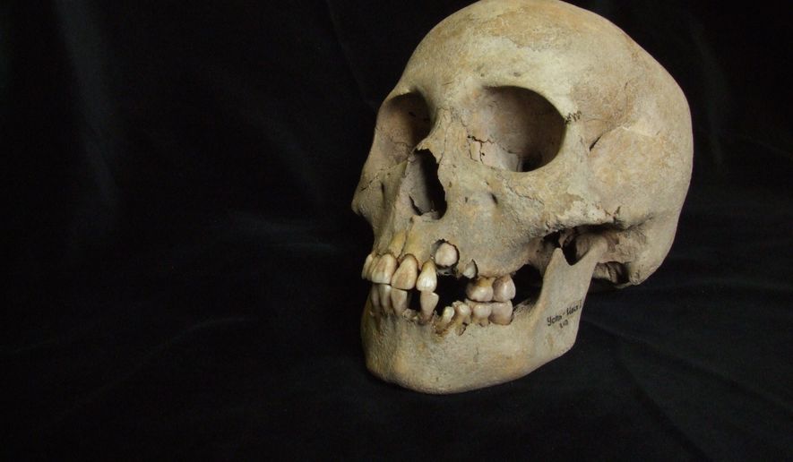 This 2006 image from Angela Lieverse shows the skull of a young girl who was buried with victims of the plague in Siberia. (Angela Lieverse via AP)