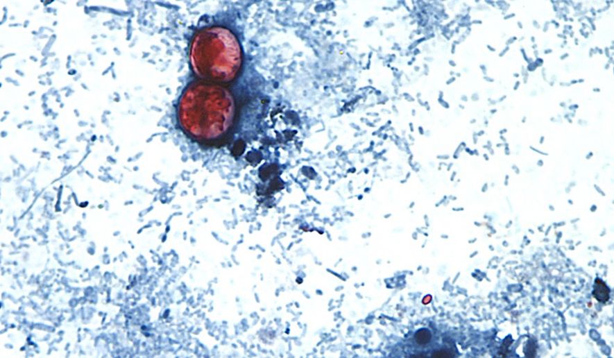 This undated photo taken through a microscope provided by the CDC shows Cyclospora cayetanensis oocysts found in a fresh stool sample which had been prepared with a formalin solution and stained with safranin. (CDC via AP)