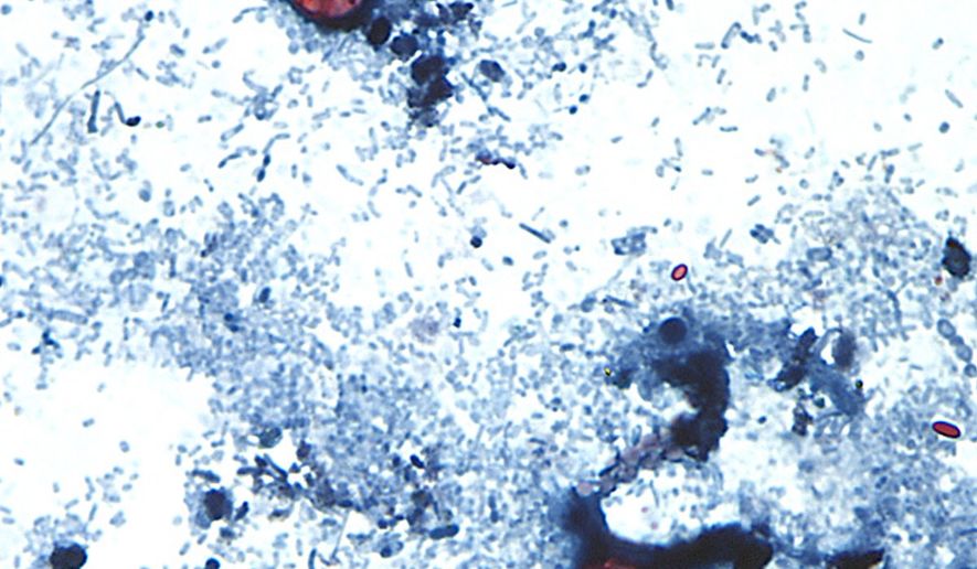 This undated photo taken through a microscope provided by the CDC shows Cyclospora cayetanensis oocysts found in a fresh stool sample which had been prepared with a formalin solution and stained with safranin. (CDC via AP)
