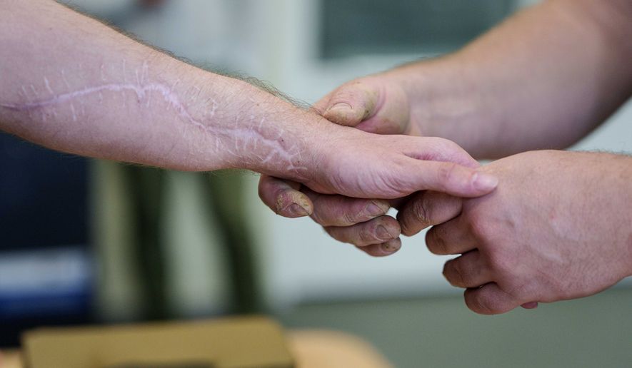Ivan Shostak, right, a blind Ukrainian war veteran touches an injured arm of his comrade during a pottery workshop at a rehabilitation center in Vinnytsia, Ukraine, on May 21, 2026. (AP Photo/Evgeniy Maloletka)