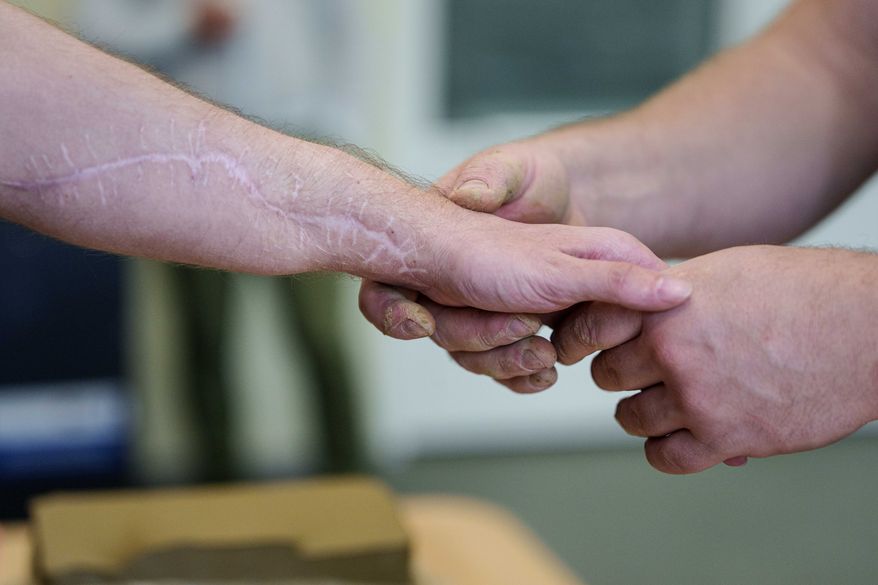 Ivan Shostak, right, a blind Ukrainian war veteran touches an injured arm of his comrade during a pottery workshop at a rehabilitation center in Vinnytsia, Ukraine, on May 21, 2026. (AP Photo/Evgeniy Maloletka)