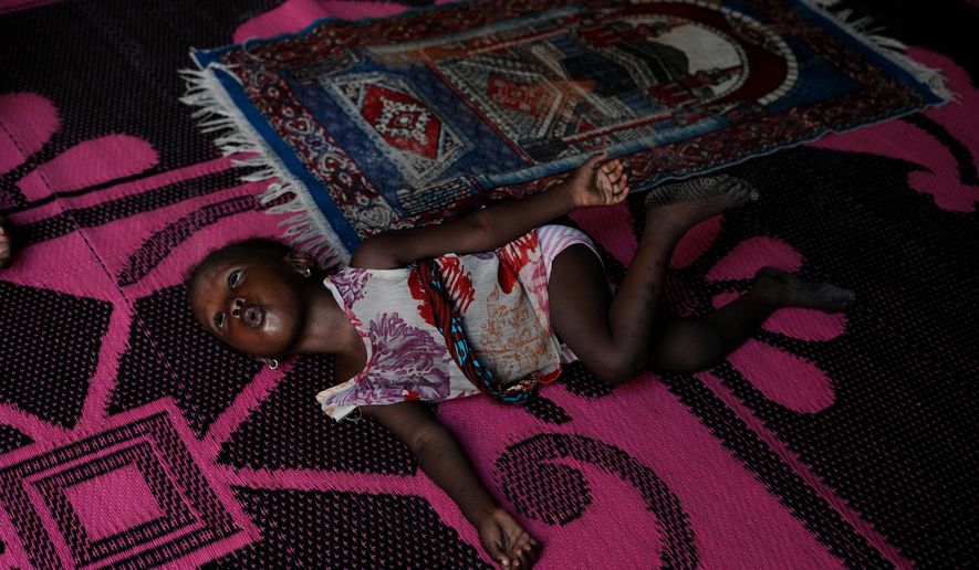 Farisa, who has relapsed into malnutrition, plays on a mat inside her house in Kware Sokoto, northwestern Nigeria, Wednesday, July 15, 2026. (AP Photo/Sunday Alamba)