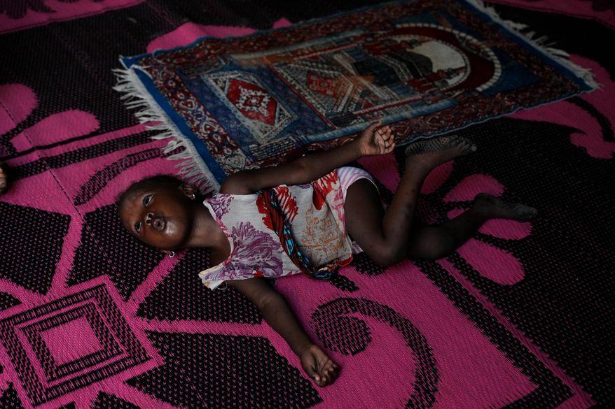 Farisa, who has relapsed into malnutrition, plays on a mat inside her house in Kware Sokoto, northwestern Nigeria, Wednesday, July 15, 2026. (AP Photo/Sunday Alamba)