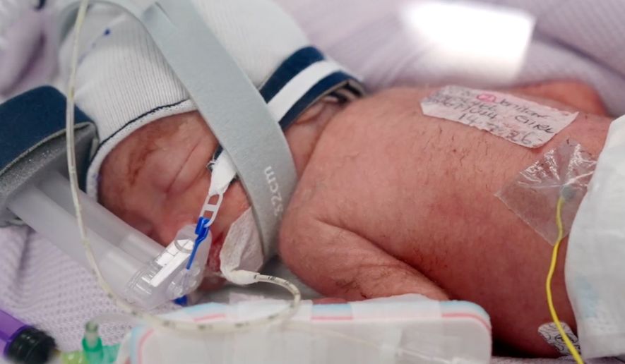 In this image taken from video taken on July 15, 2026, one of the quadruplets born at Metro North Health hospital lies in an incubator in Brisbane, Australia. (Metro North Health via AP)