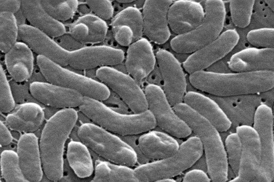 FILE - This 2005 electron microscope image provided by the Centers for Disease Control and Prevention shows Vibrio vulnificus bacteria. (Janice Haney Carr/Centers for Disease Control and Prevention via AP, File)