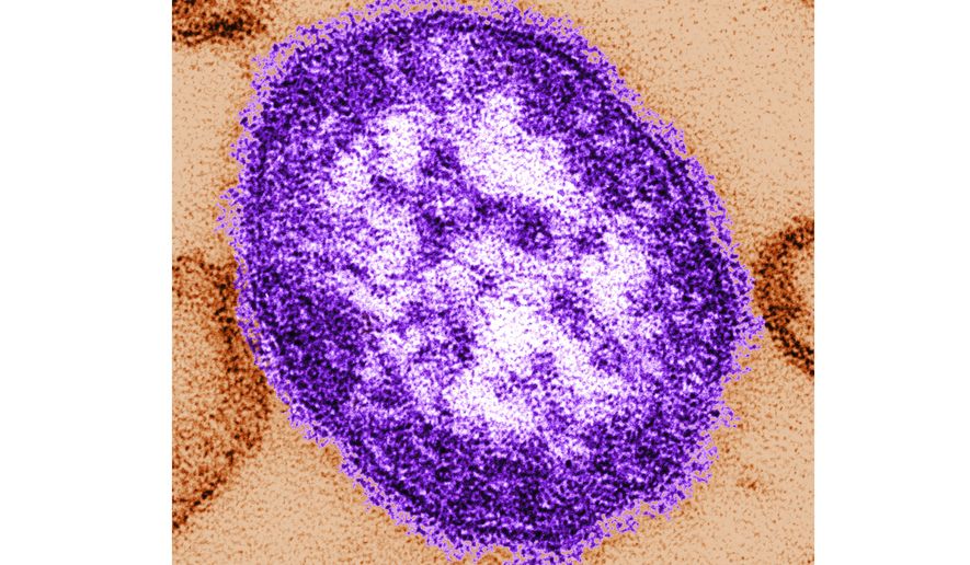 This undated image made available by the Centers for Disease Control and Prevention on Feb. 4, 2015, shows an electron microscope image of a measles virus particle. (Cynthia Goldsmith/Centers for Disease Control and Prevention, via AP) **FILE**