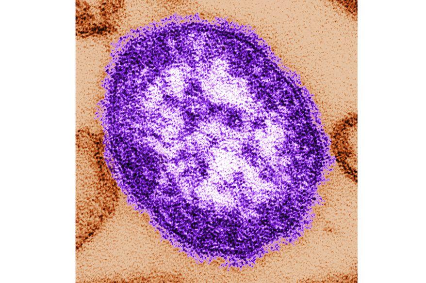 This undated image made available by the Centers for Disease Control and Prevention on Feb. 4, 2015, shows an electron microscope image of a measles virus particle. (Cynthia Goldsmith/Centers for Disease Control and Prevention, via AP) **FILE**