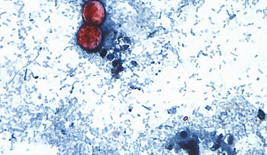 FILE - This undated photo taken through a microscope and provided by the CDC shows Cyclospora cayetanensis oocysts found in a fresh stool sample which had been prepared with a formalin solution and stained with safranin. (CDC via AP, File)