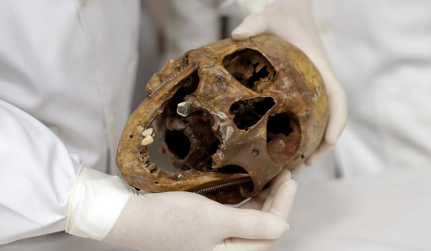 FILE - In this Saturday, Dec. 7, 2016 photo, forensic doctor Daniel Munoz shows the skull of Nazi war criminal Josef Mengele, at the school of medicine of Sao Paulo University in Sao Paulo, Brazil. (AP Photo/Andre Penner, File)