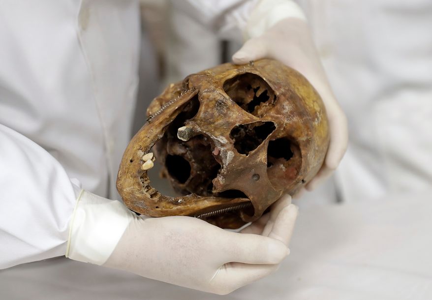 FILE - In this Saturday, Dec. 7, 2016 photo, forensic doctor Daniel Munoz shows the skull of Nazi war criminal Josef Mengele, at the school of medicine of Sao Paulo University in Sao Paulo, Brazil. (AP Photo/Andre Penner, File)